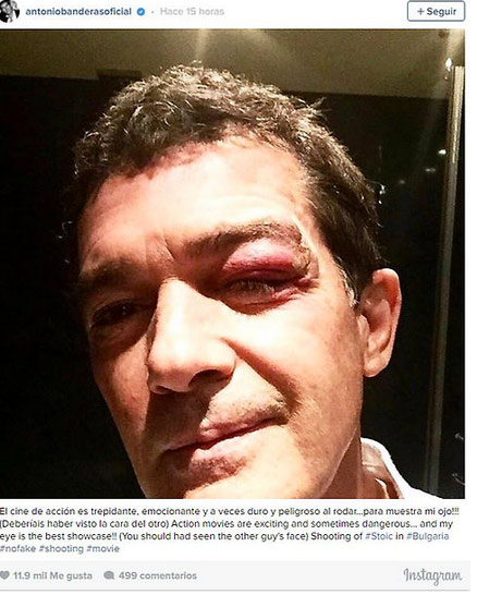 antonio banderas accidente ne el rodaje de stoic