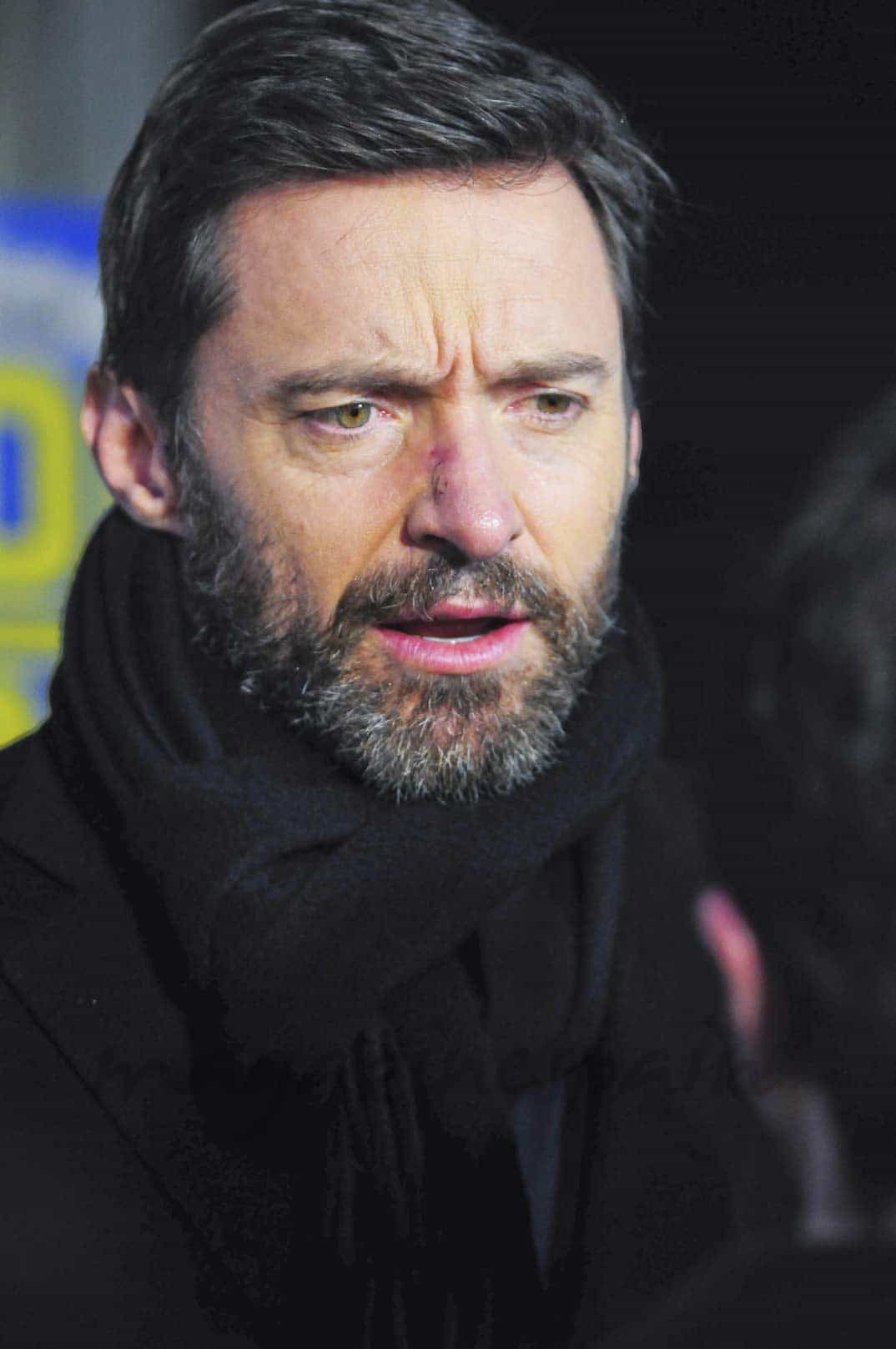 hugh-jackman peimera salida despues de ser operado de cancer