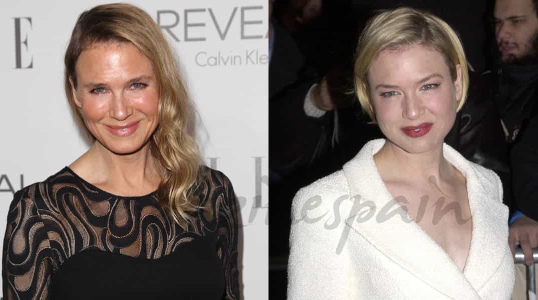 renee-zellweger-antes-despues