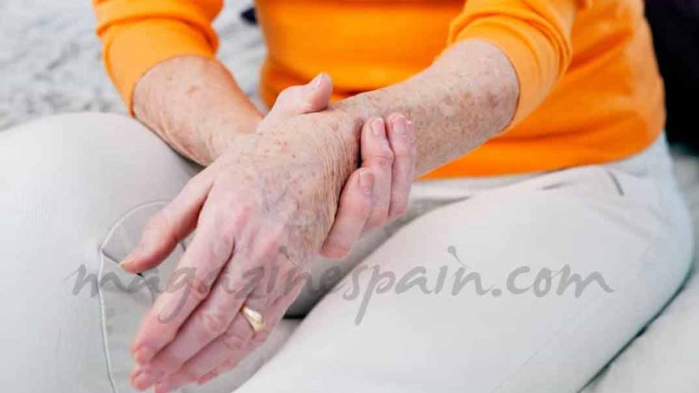 Qué es la artrosis u osteoartritis deformante
