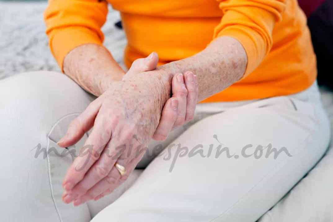 Qué es la artrosis u osteoartritis deformante