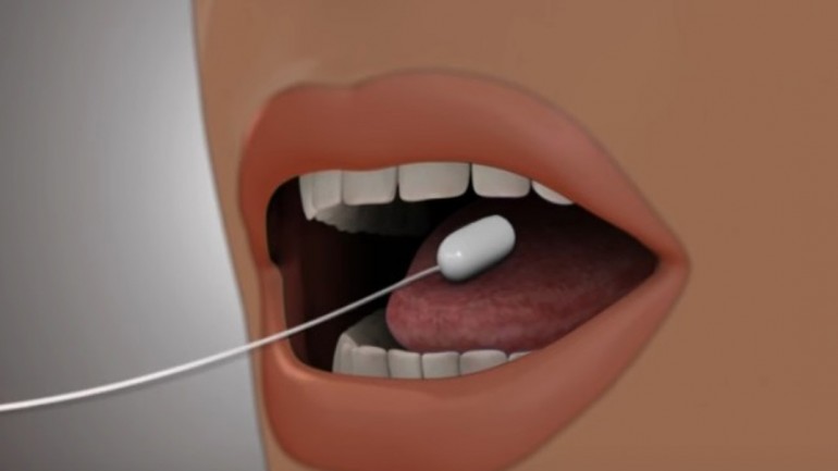 Lo último para adelgazar: Balón Ingerible