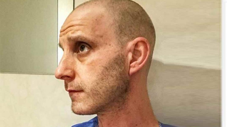 Dani Rovira no pierde el humor al mostrar la realidad de una sesión de radioterapia