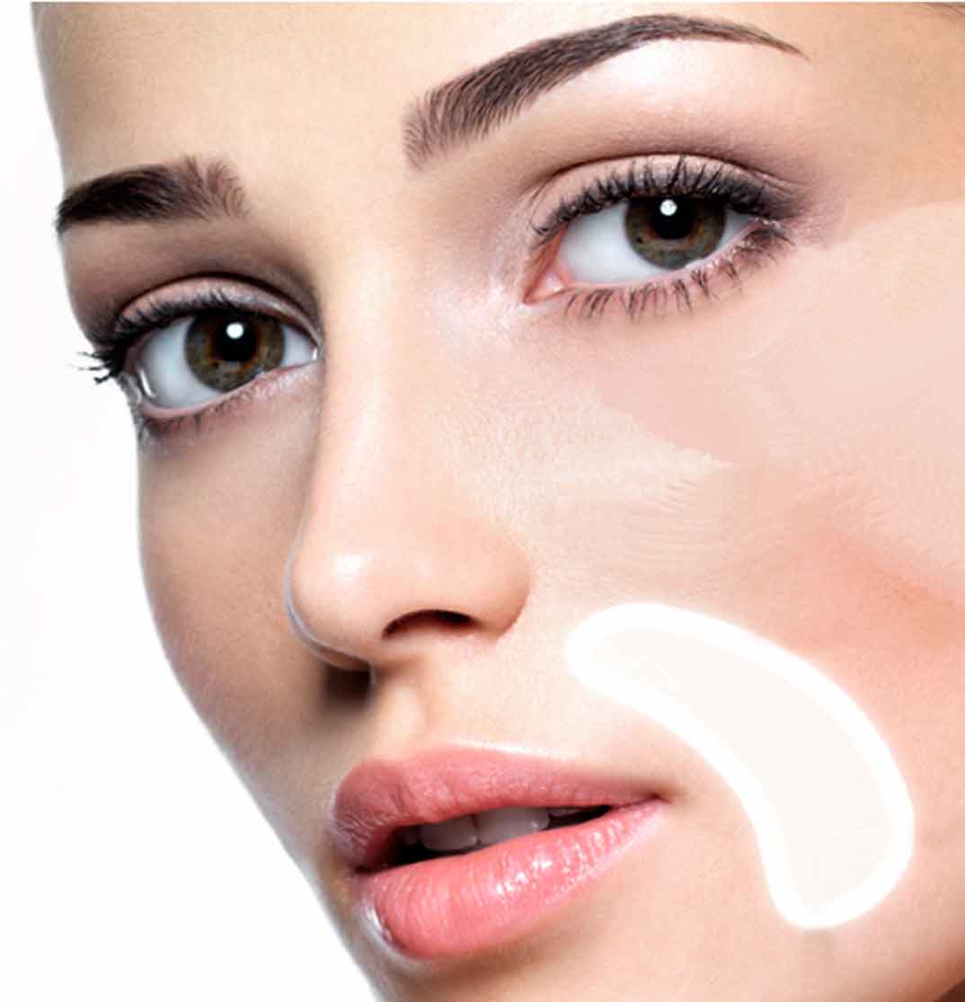 parches-labial-entrada