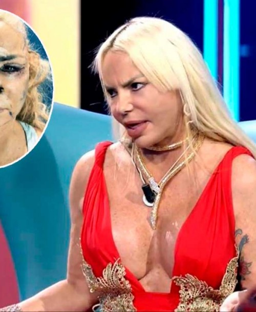 Leticia Sabater muestra su nuevo rostro tras gastarse 15.000 euros