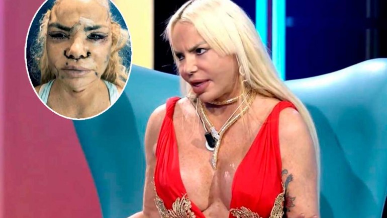 Leticia Sabater muestra su nuevo rostro tras gastarse 15.000 euros