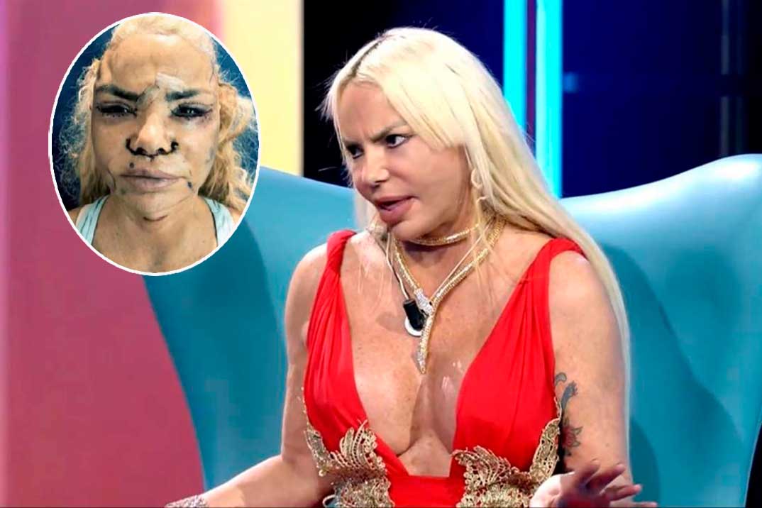 Leticia Sabater muestra su nuevo rostro tras gastarse 15.000 euros