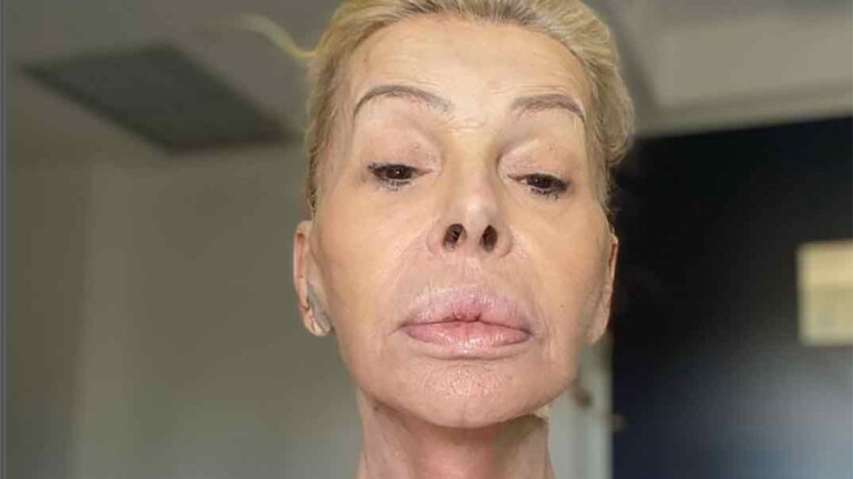 Bibiana Fernández, ingresada en el hospital
