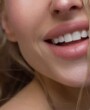Labios voluminosos y completamente naturales gracias al relleno