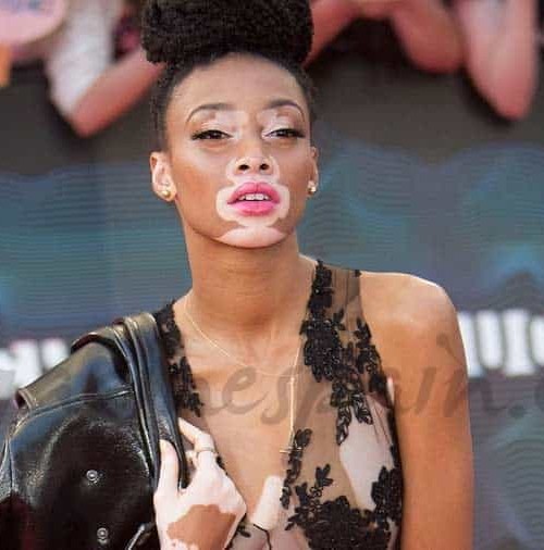 “Desigual” ficha a Winnie Harlow, la única modelo con vitiligo