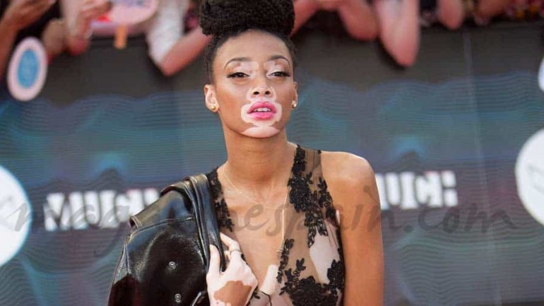 «Desigual» ficha a Winnie Harlow, la única modelo con vitiligo