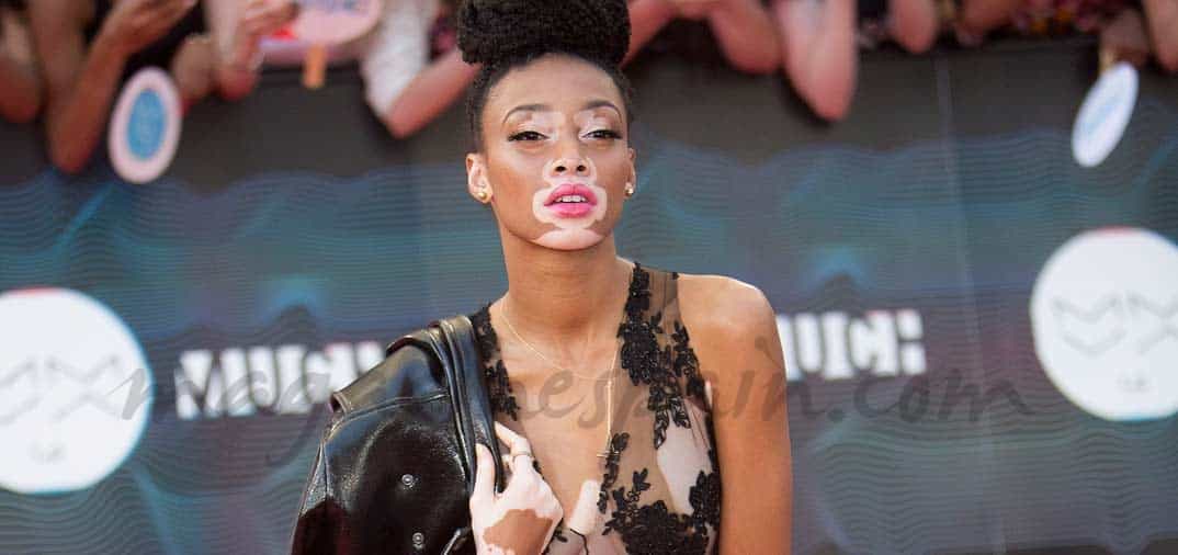 «Desigual» ficha a Winnie Harlow, la única modelo con vitiligo