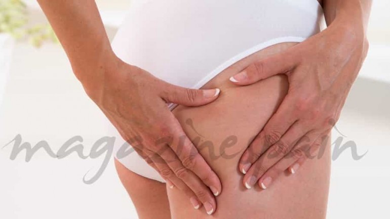 Nuevos Tratamientos Fusion contra la celulitis
