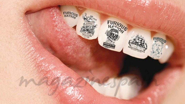 Peligrosas modas dentales