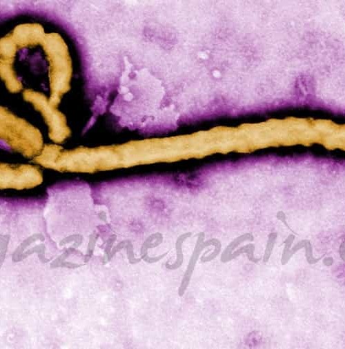 La infección por el virus Ébola
