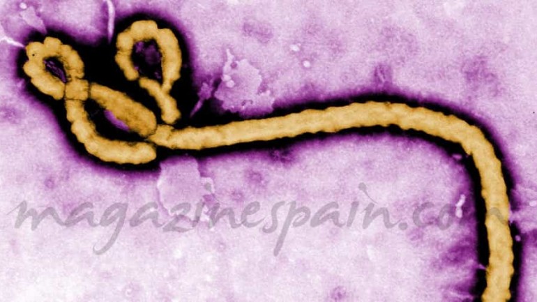 La infección por el virus Ébola