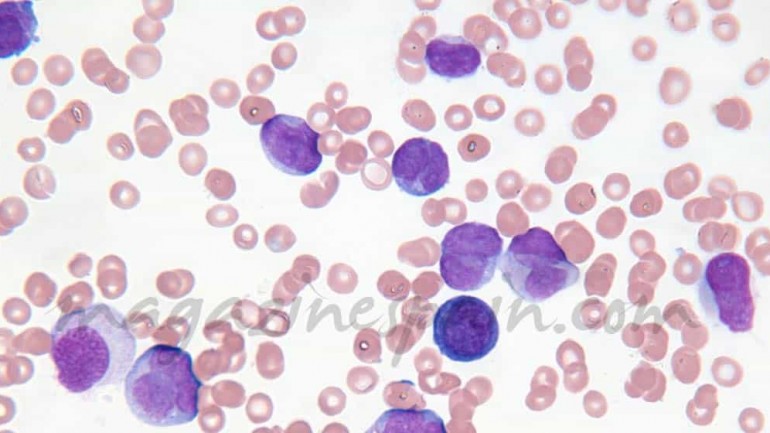 Haceros donantes de médula ósea